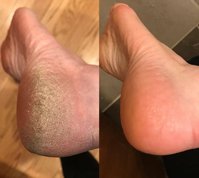 Before and after photo