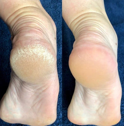 Before and after photo