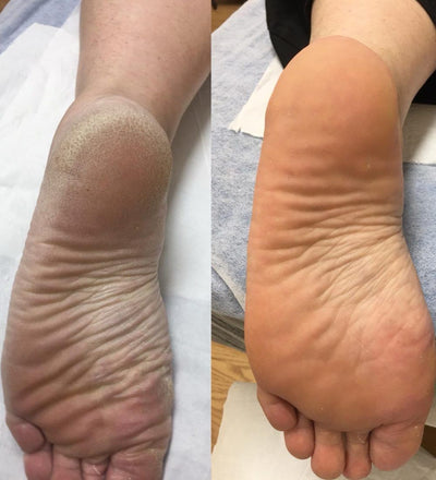 Before and after photo