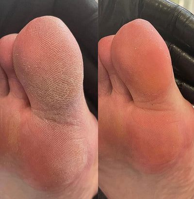 Before and after photo