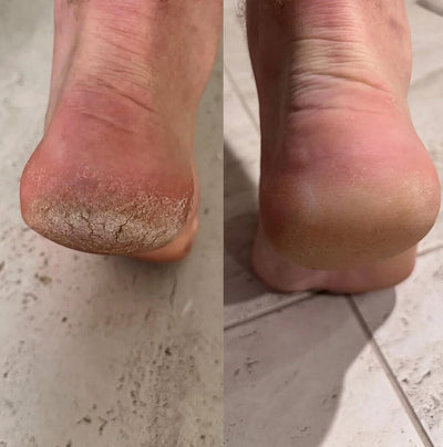 Before and after photo