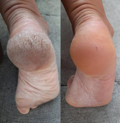 Before and after photo
